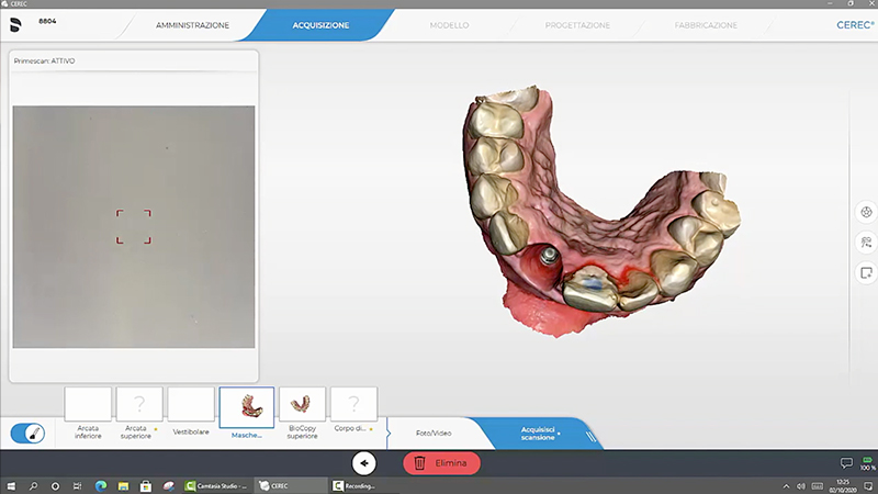Impronta digitale dei tessuti molli