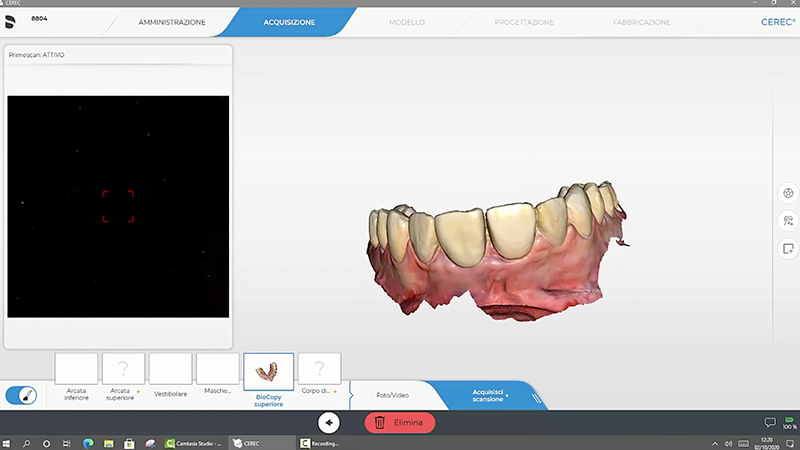 Copia Biogenerica del mock-up e del provvisorio avvitato