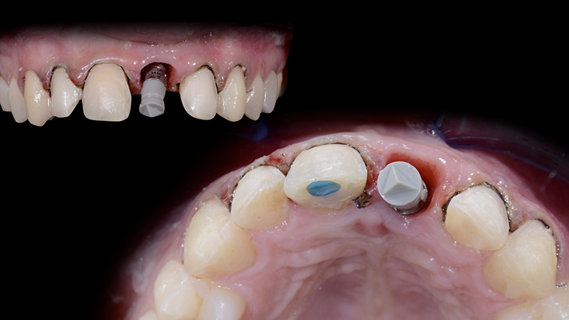 Preparazioni al microscopio
