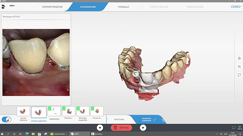 Impronta digitale definitiva