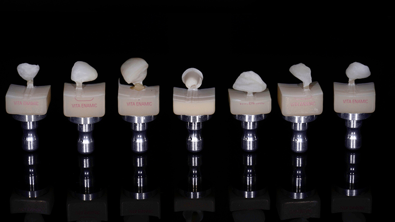 Restauri protesici definitivi fresati