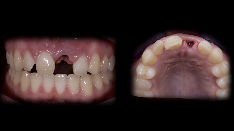 Stato iniziale intraorale