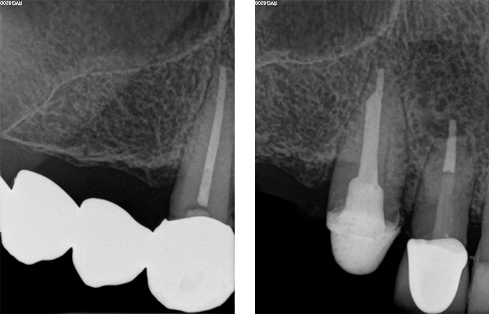 Radiografie iniziali 13, 12