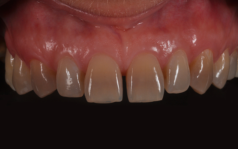 dettaglio dell'arcata superiore