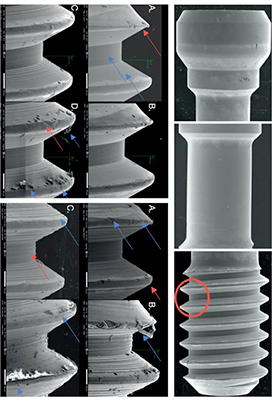 Immagine proveniente da studio "Engagin vs. Non- Engaging Abutments: An In Vitro Study"