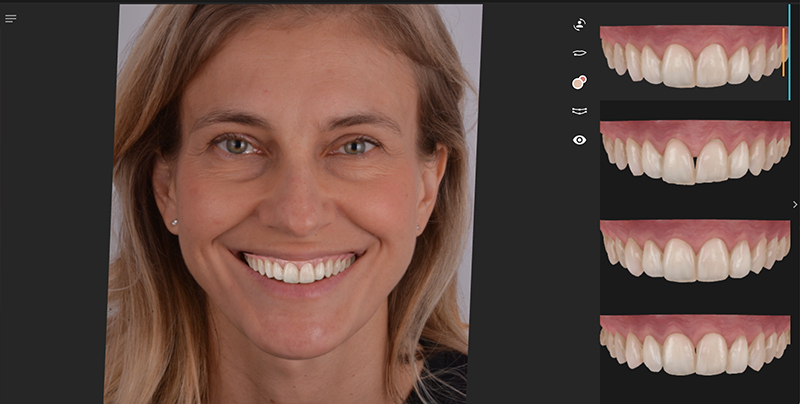 sviluppo diverse forme dentali con AI