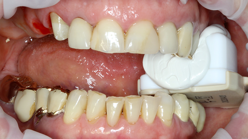 esecuzione Cone Beam