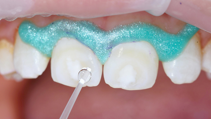 Applicazione Icon-Dry