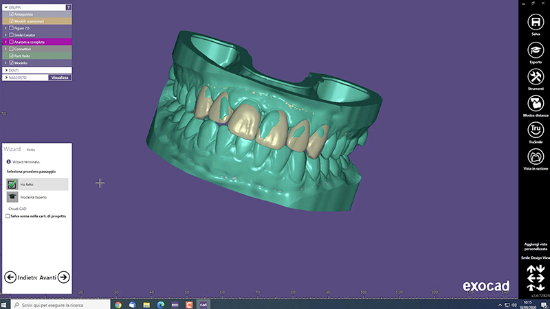 Modello STL con la nuova morfologia