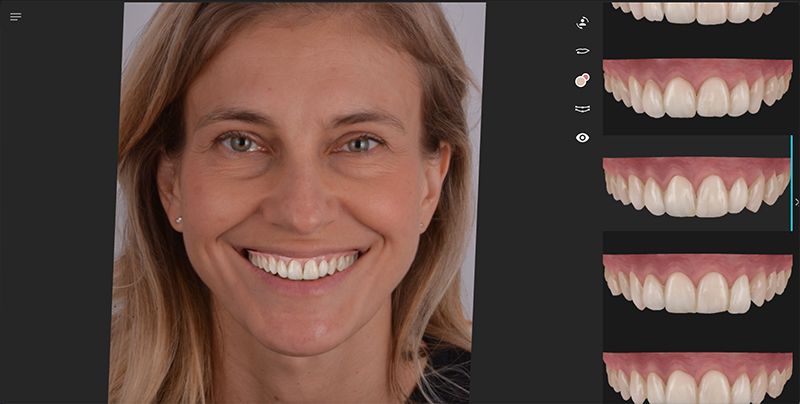 sviluppo forme dentali con AI