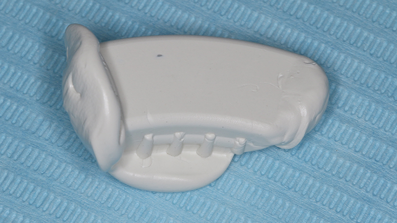 esecuzione della Cone Beam con repere per il protocollo "istant registration"