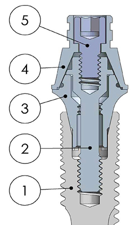 Immagine inerente lo studio "The morphology of collected dental implant prosthetsis screws surface after six months to twenty years in chewing"