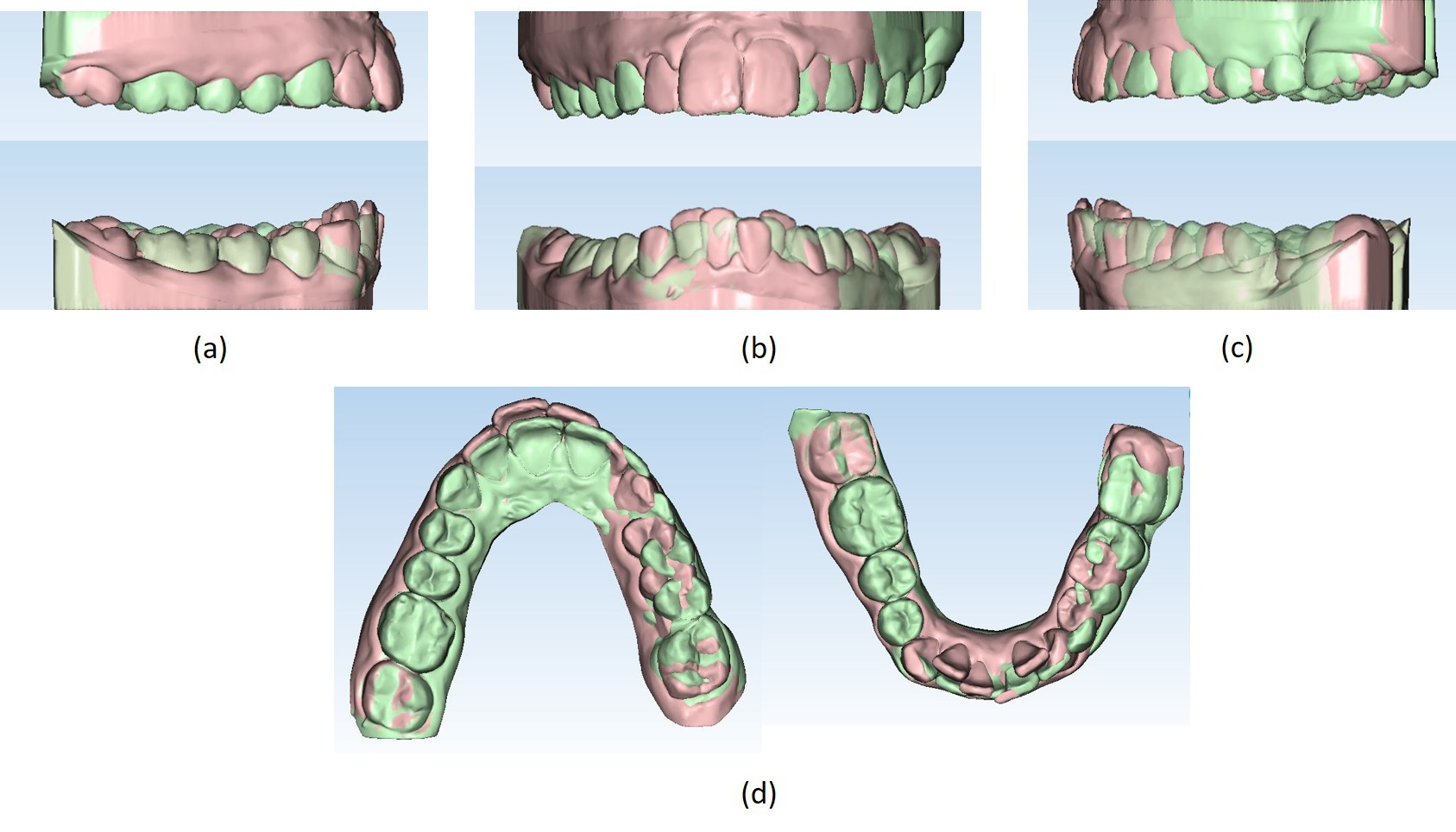 Sovrapposizione dei modelli virtuali