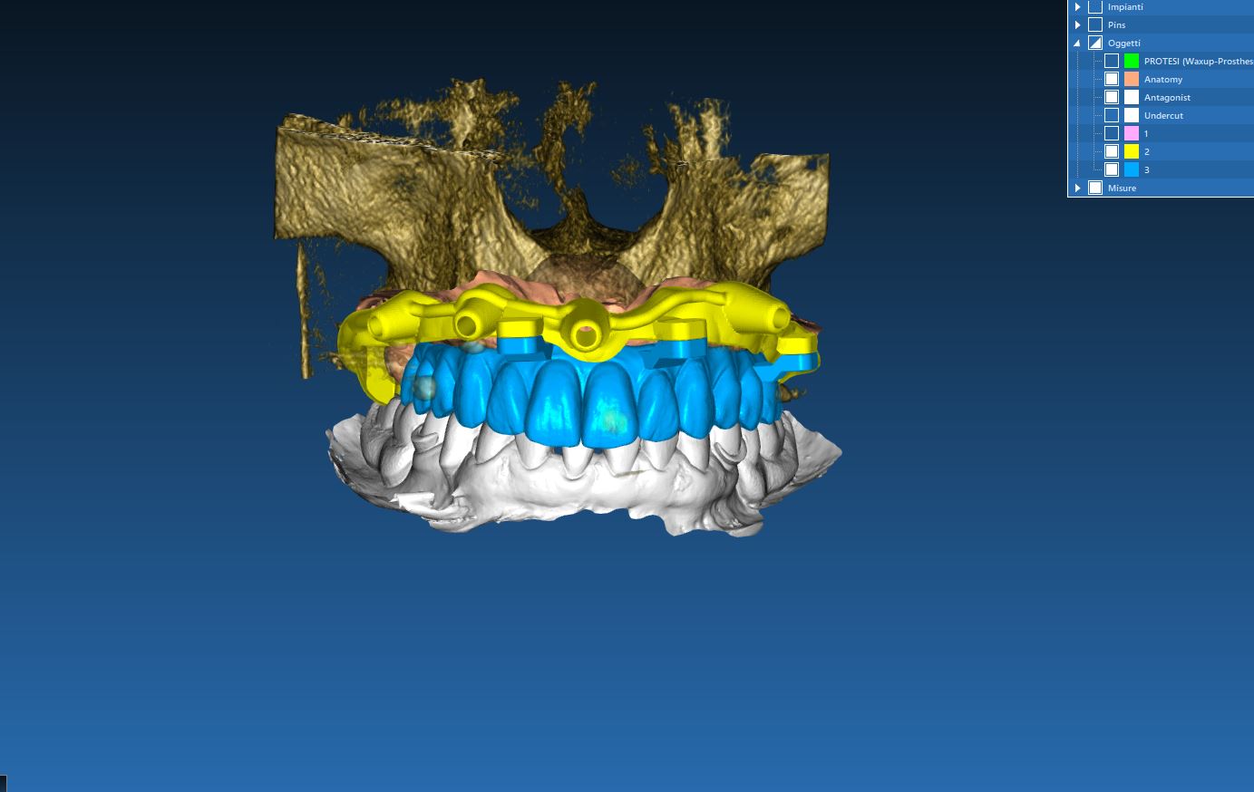 visualizzazione 3d del nuovo impianto