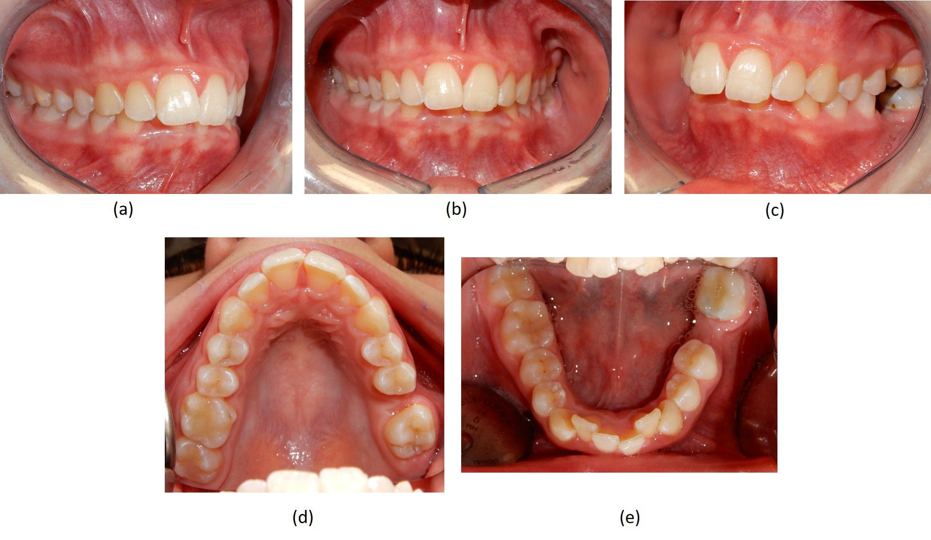 Fotografie intraorali  pre-trattamento