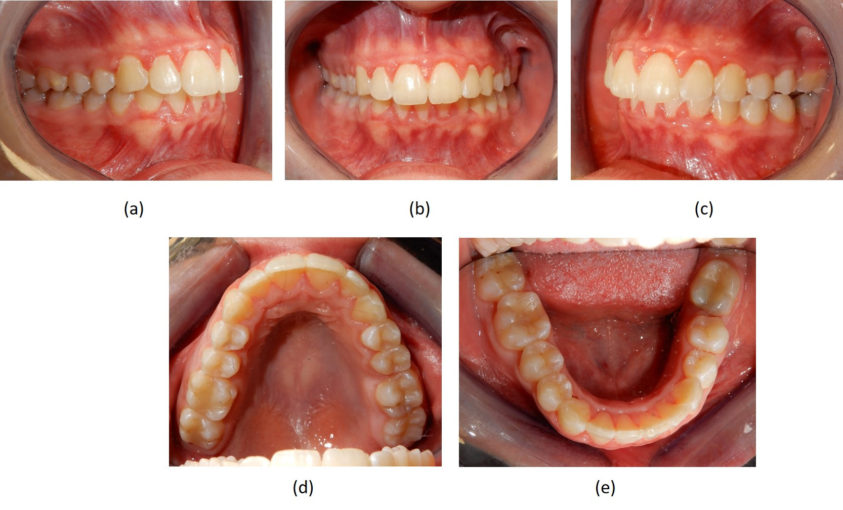 Fotografie intraorali post-trattamento