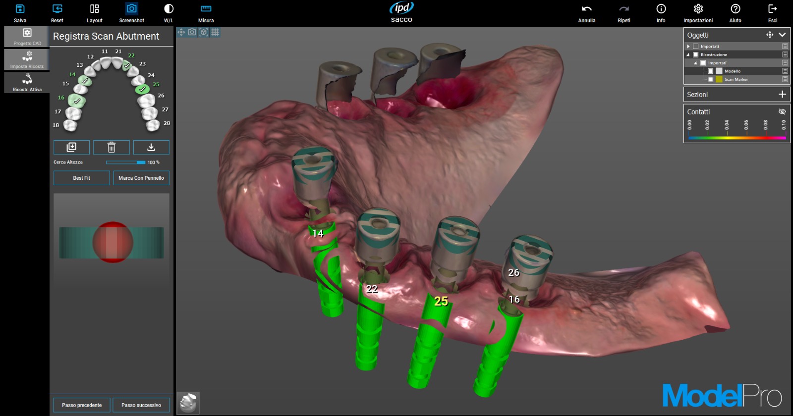 Scansione intraorale in ModelPro