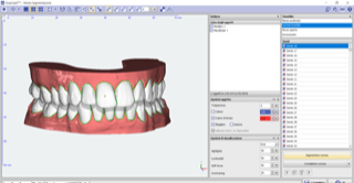 segmentazione arcate