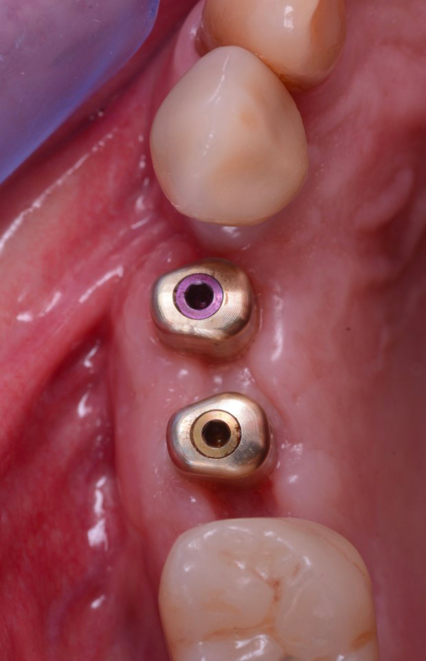 i-Physio in posizione