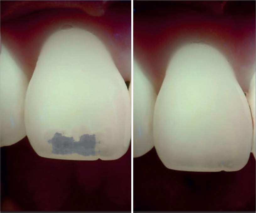 analisi dei difetti su entrambi gli elementi