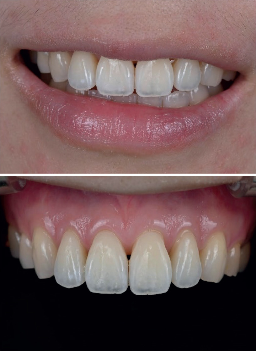 valutazione fotografica del risultato finale