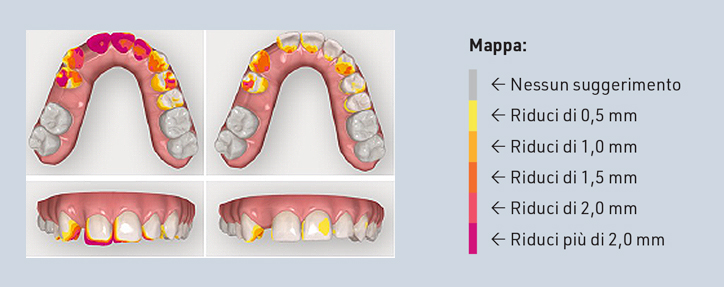 strumento di analisi della massa dentale