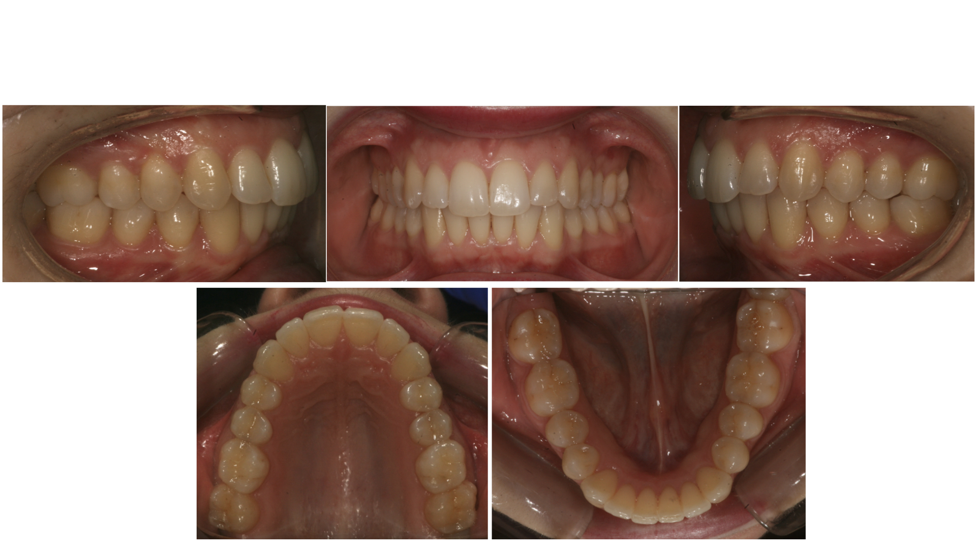 foto intra orali finali