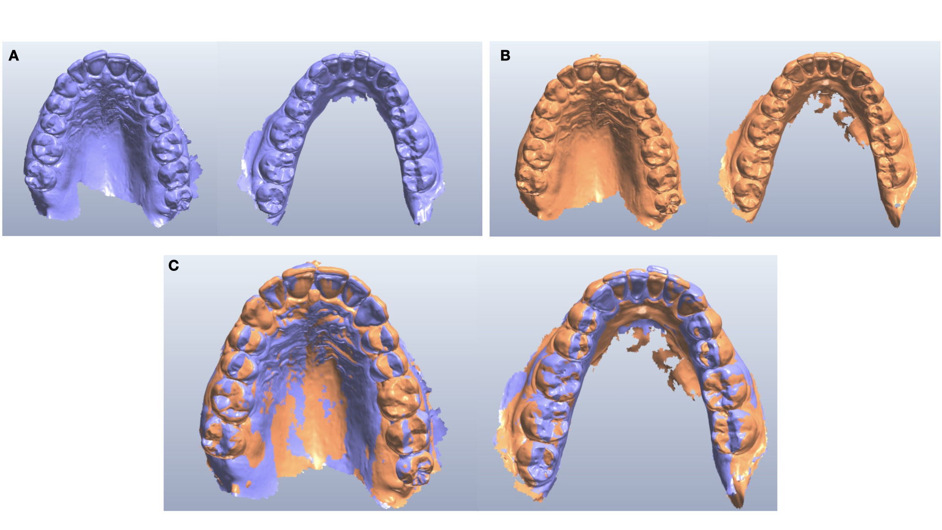 sovrapposizioni arcate