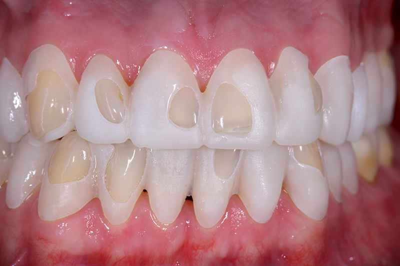 Guide di preparazione in situ