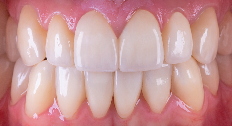 risultato finale vista frontale