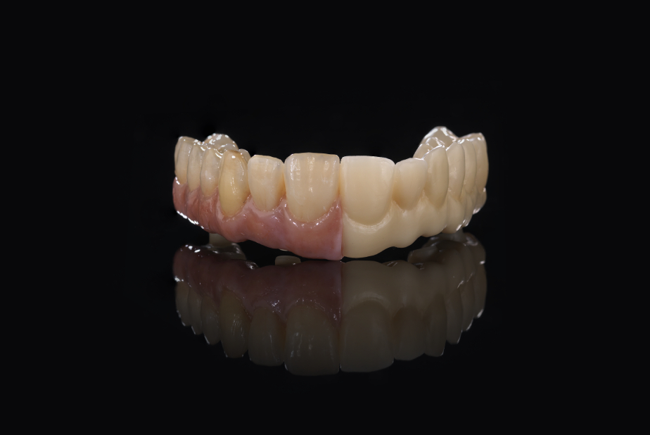 Modello con Zolid Bion di MDT Benjamin Votteler