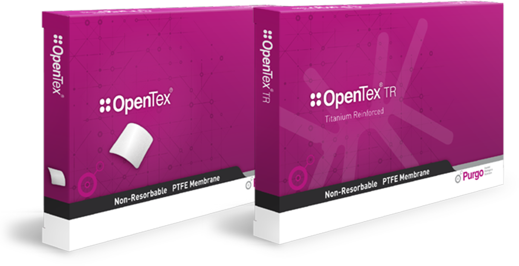 OpenTex e OpenTexTR