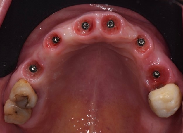 Profili di emergenza ideali disegnati dagli iPhysio