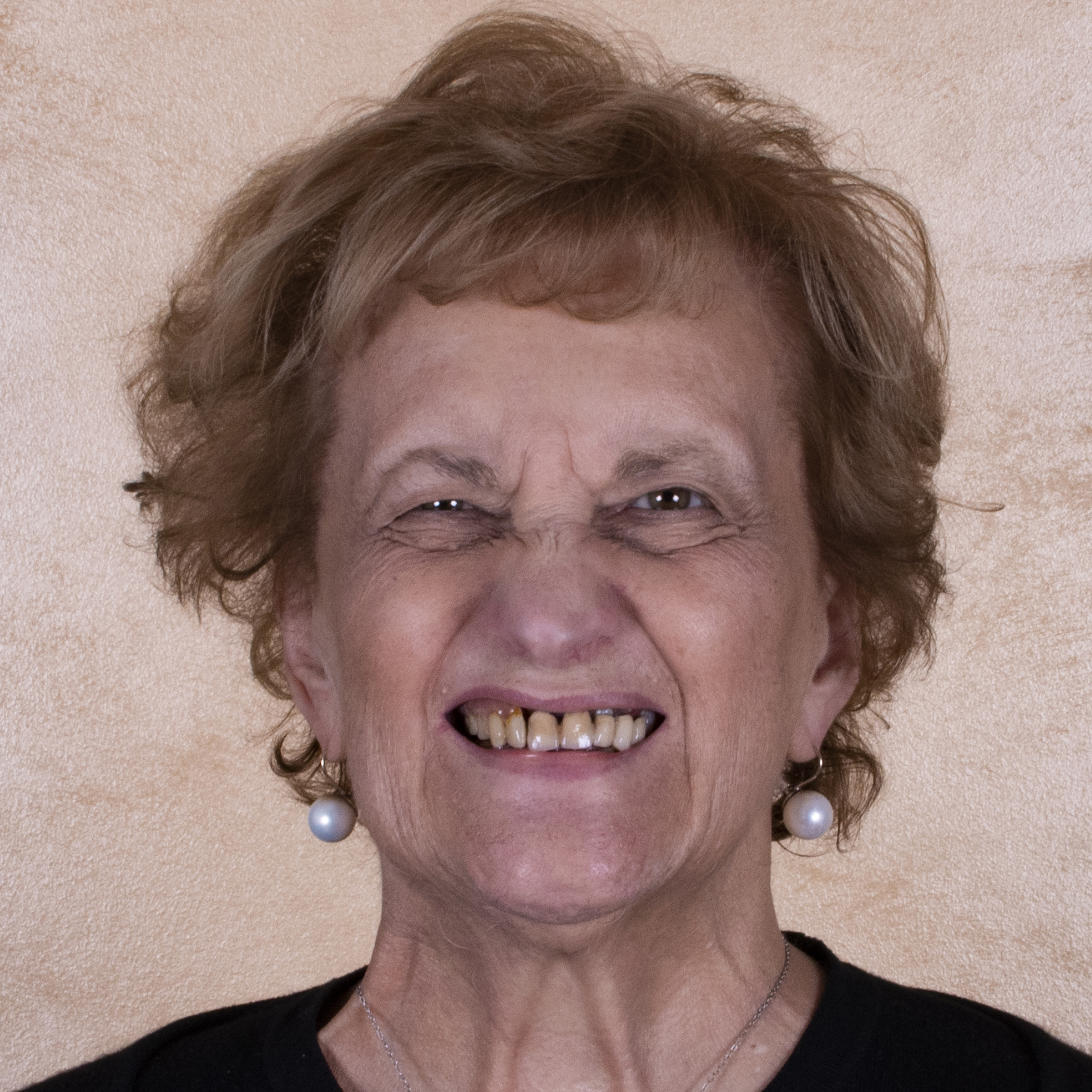 Situazione iniziale aspetto extraorale