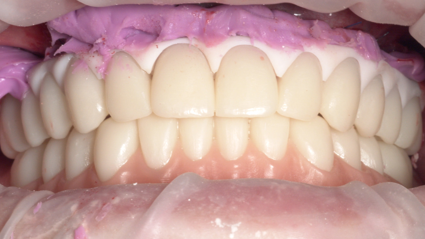 Fig. 10. Verifica della correttezza della registrazione dopo la chirurgia