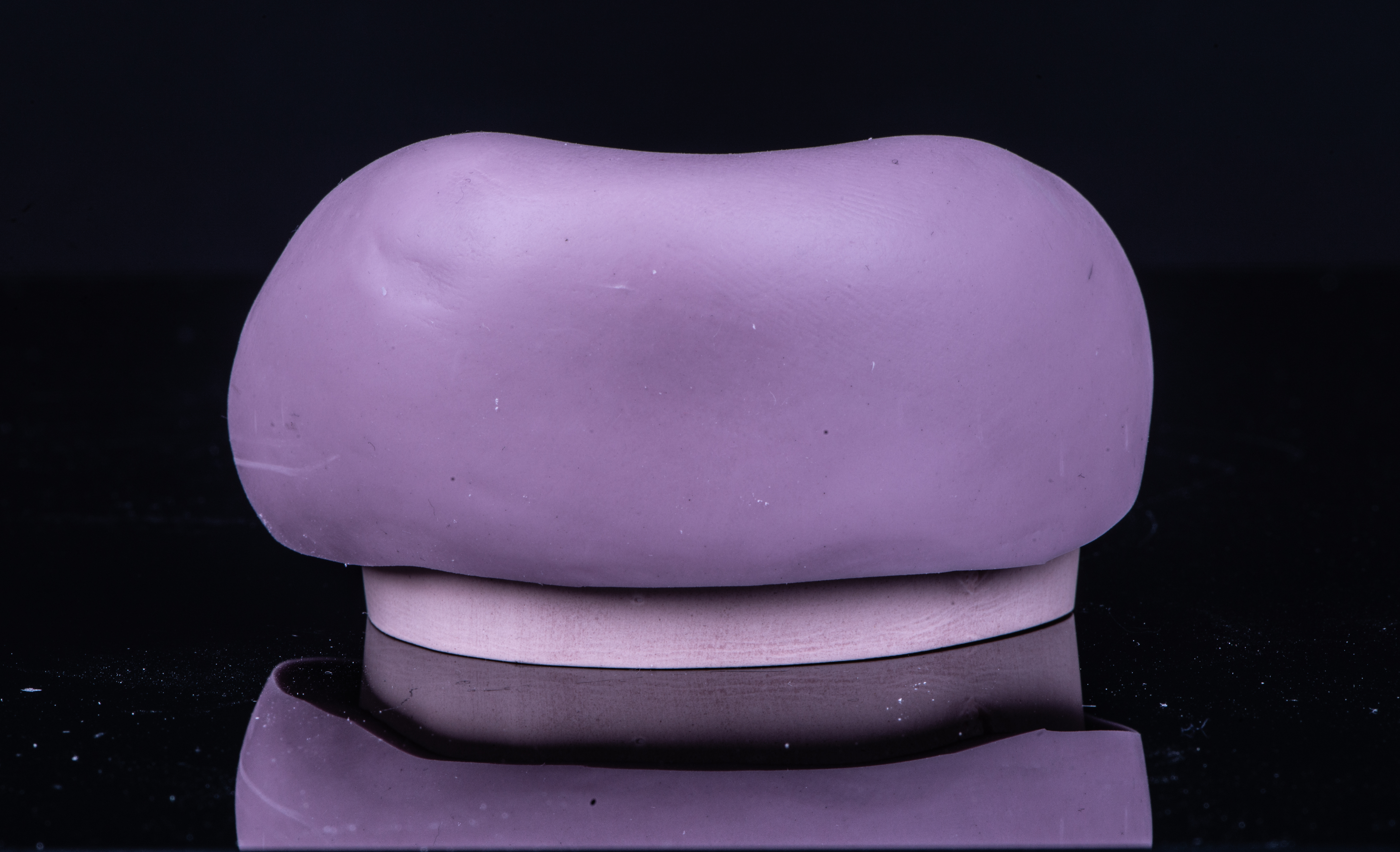 Fig. 14. Mascherina in silicone per il riposizionamento dei denti provvisori durante la fase di resinatura