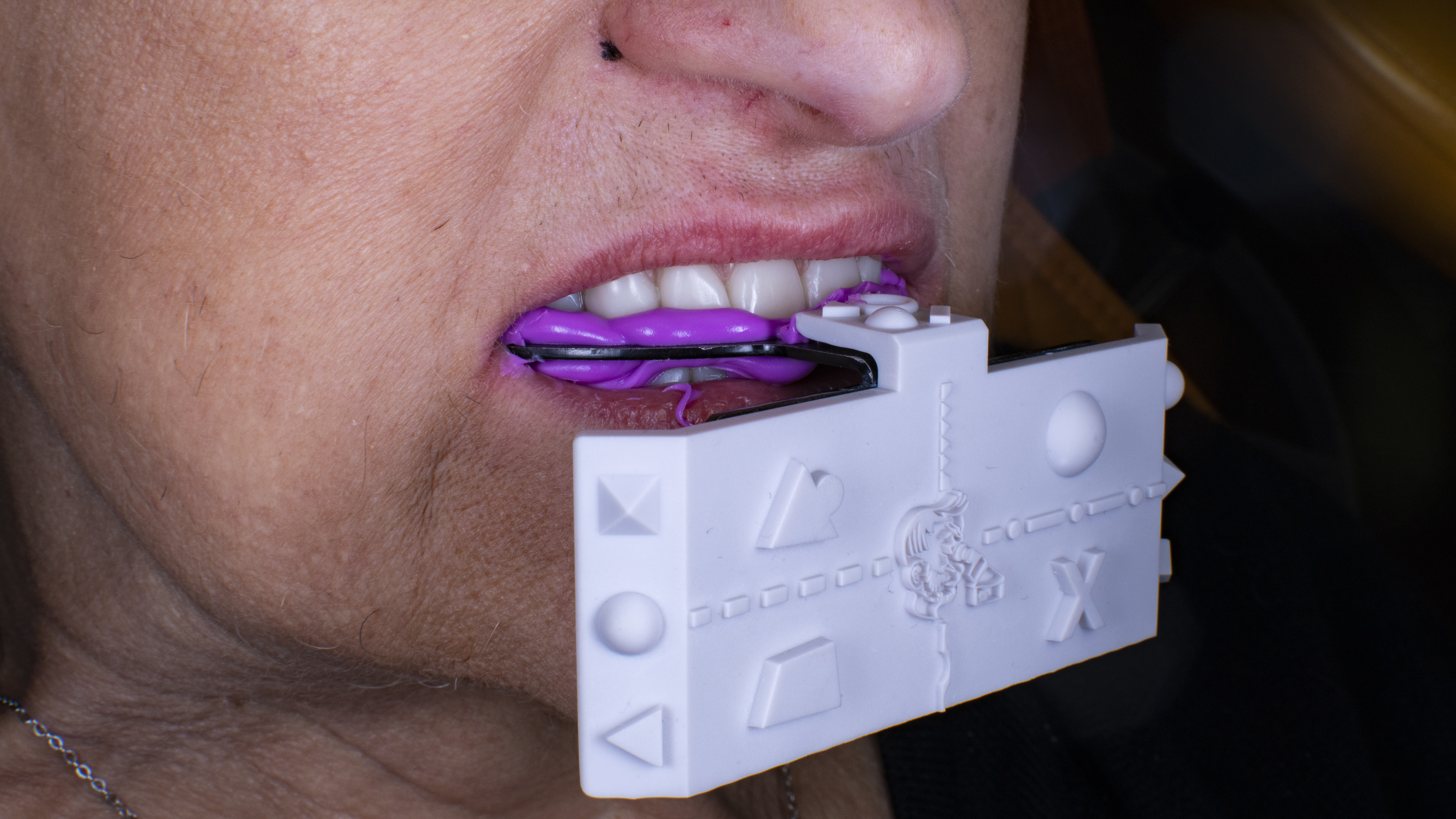 Fig. 4. Adattamento del fork durante la scansione facciale