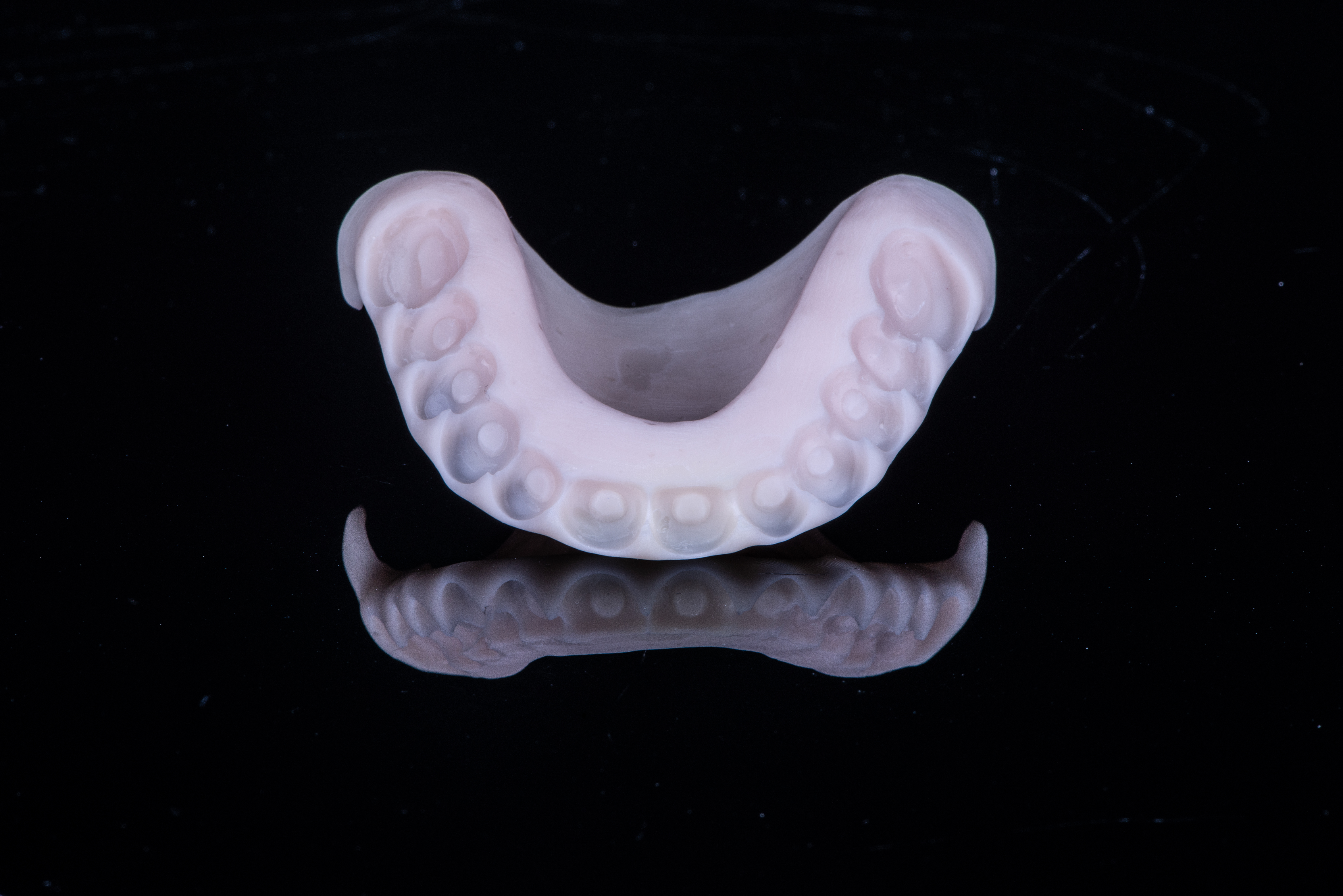 Fig. 7. Base stampata del prototipo superiore che fornirà lo stop palatale durante le fasi di registrazione