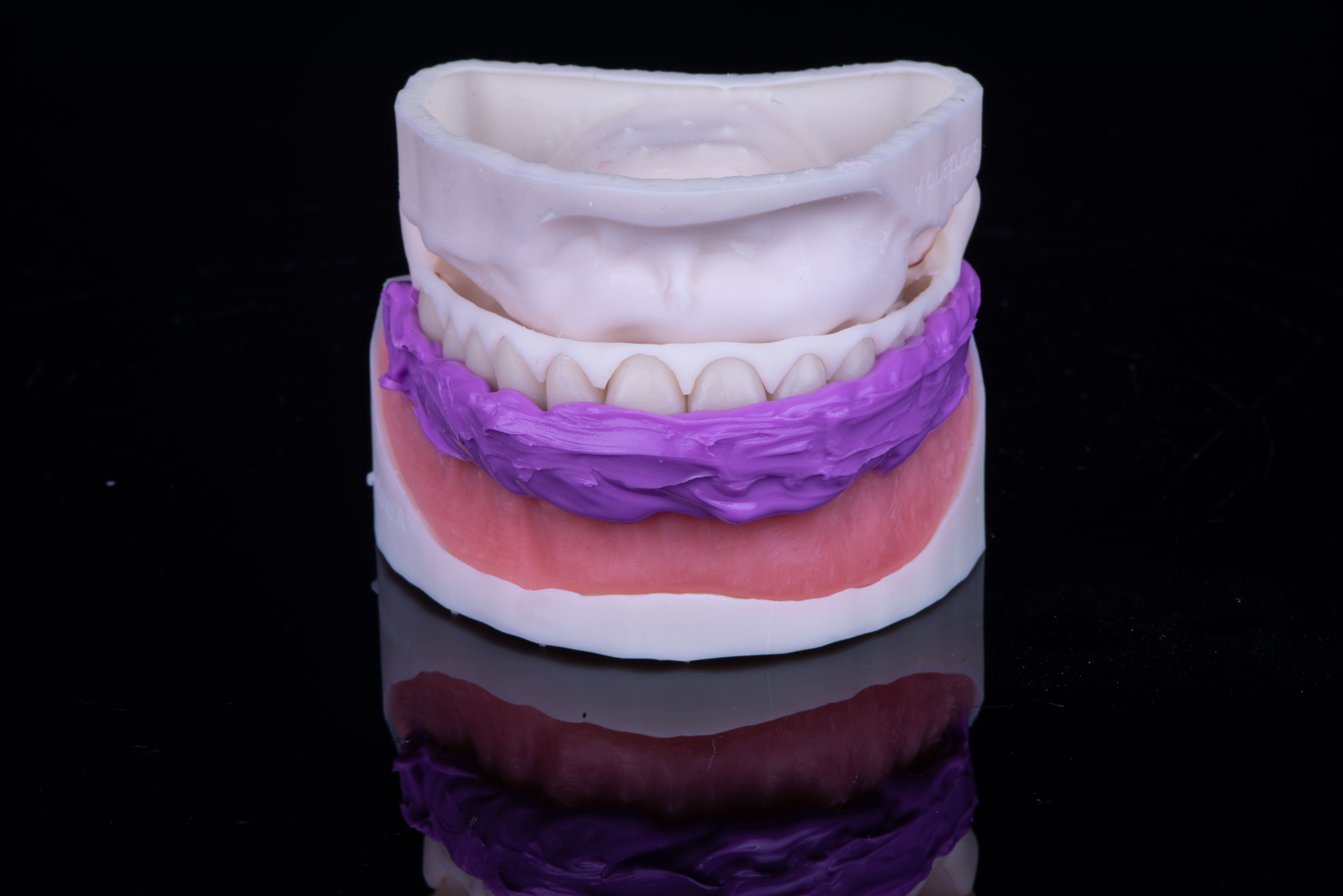 Fig. 9. Mascherina in silicone per relazionare il prototipo superiore alla protesi provvisoria inferiore