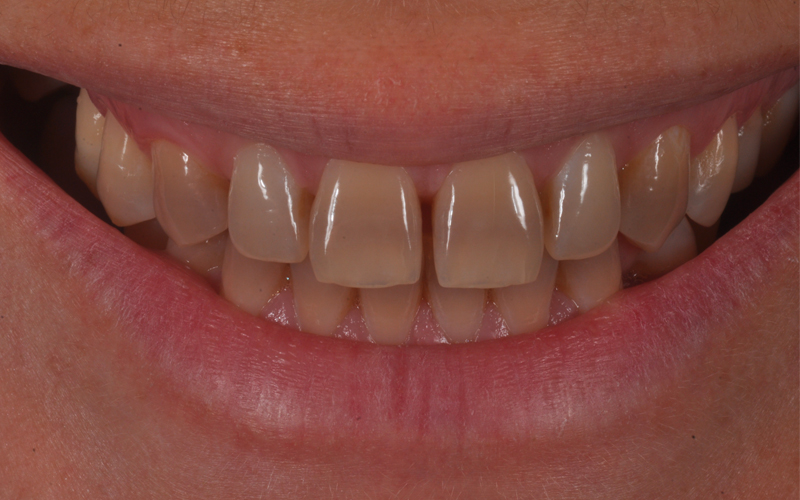 discomfort estetico paziente