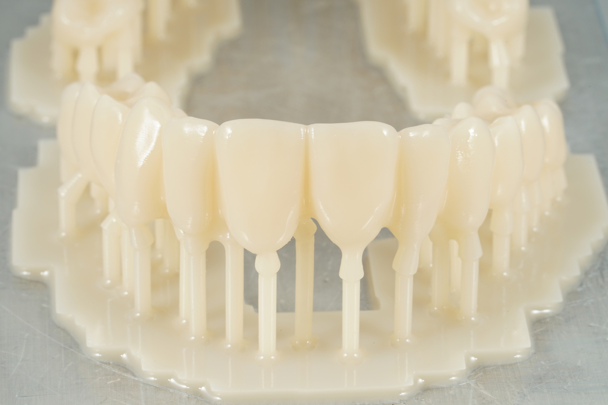approfondimento abutment 3