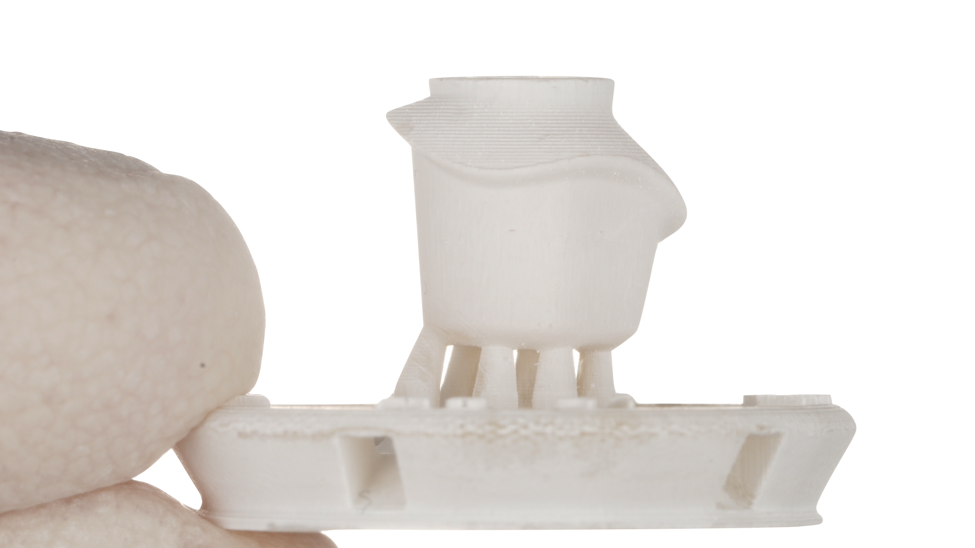 Esempio fornito da Dr A. Cacioppo di abutment provvisorio personalizzato stampato in ChairSide (PA)