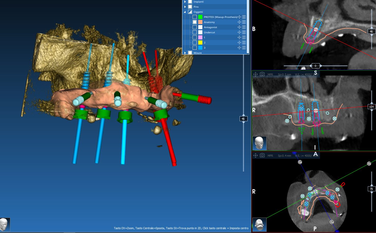 visualizzazione della simulazione 3d del posizionamento degli impianti