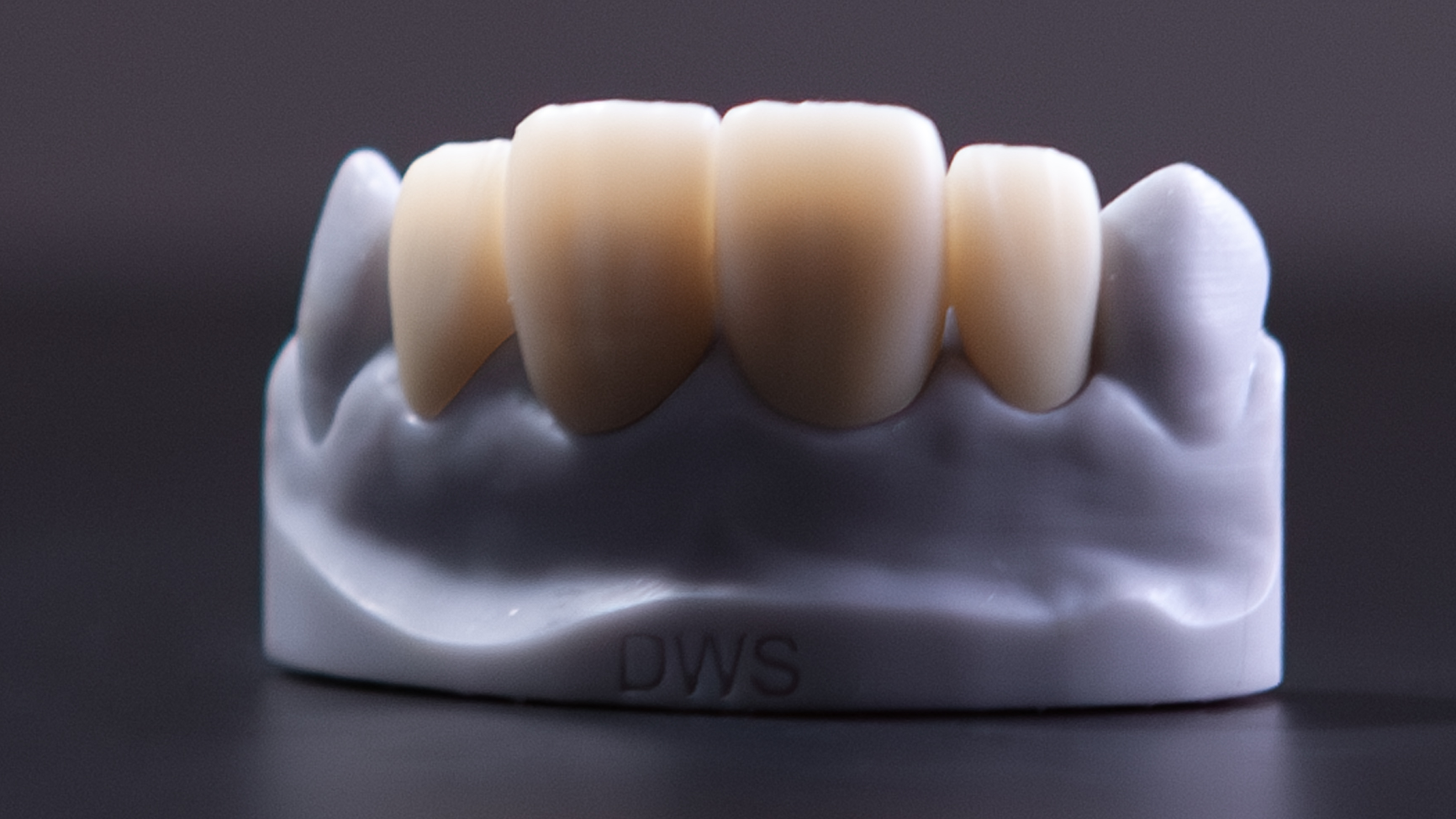 10.Elementi definitivi stampati con D-Fab e Resina Irix max photoshade, Immagine fornita da DWS (VI)