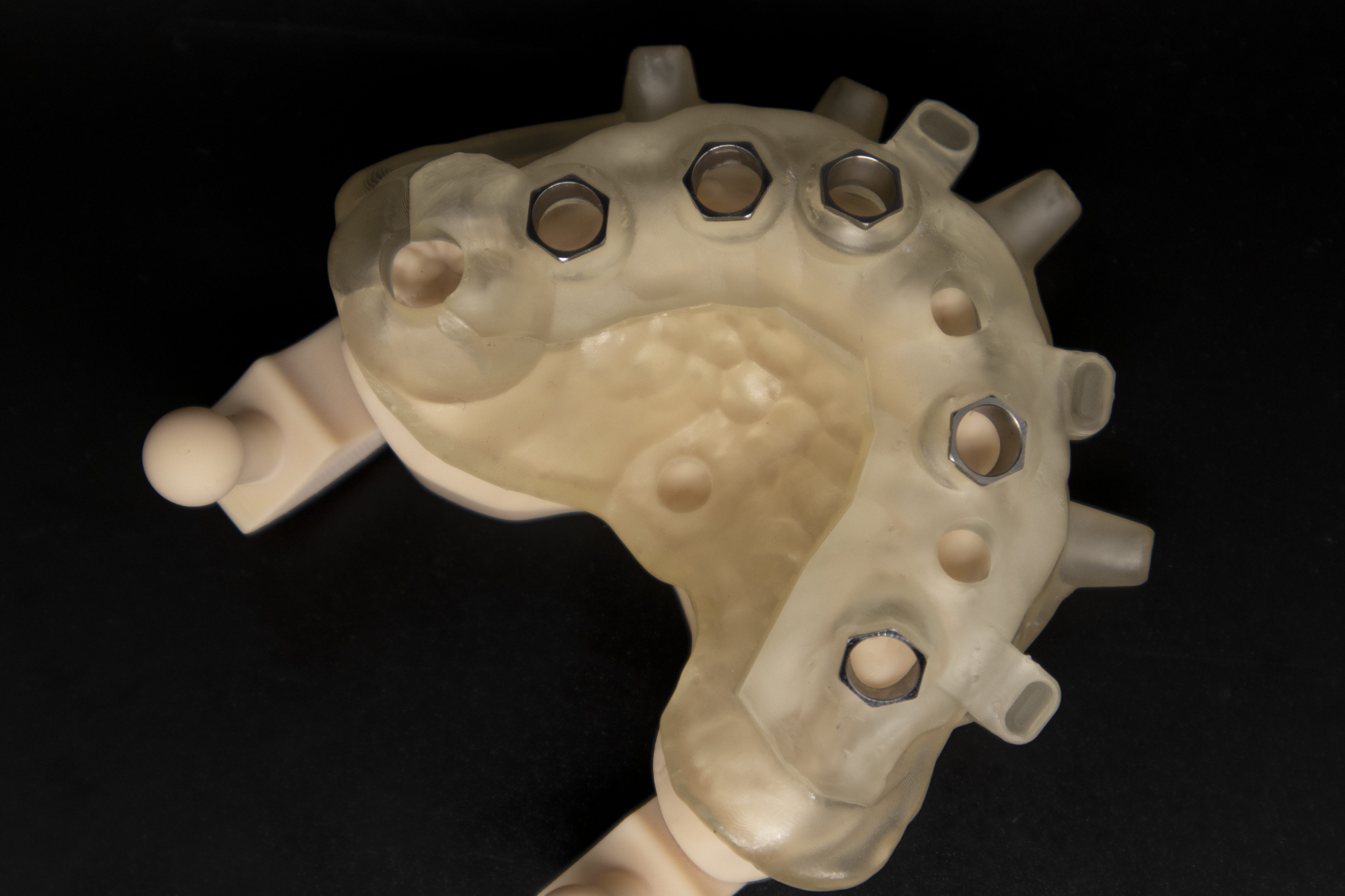 Protesi finita e toronto bridge 5