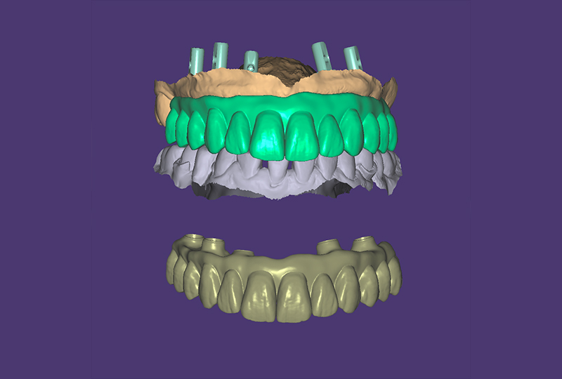 Passaggi in cad per la costruzione della iBar.