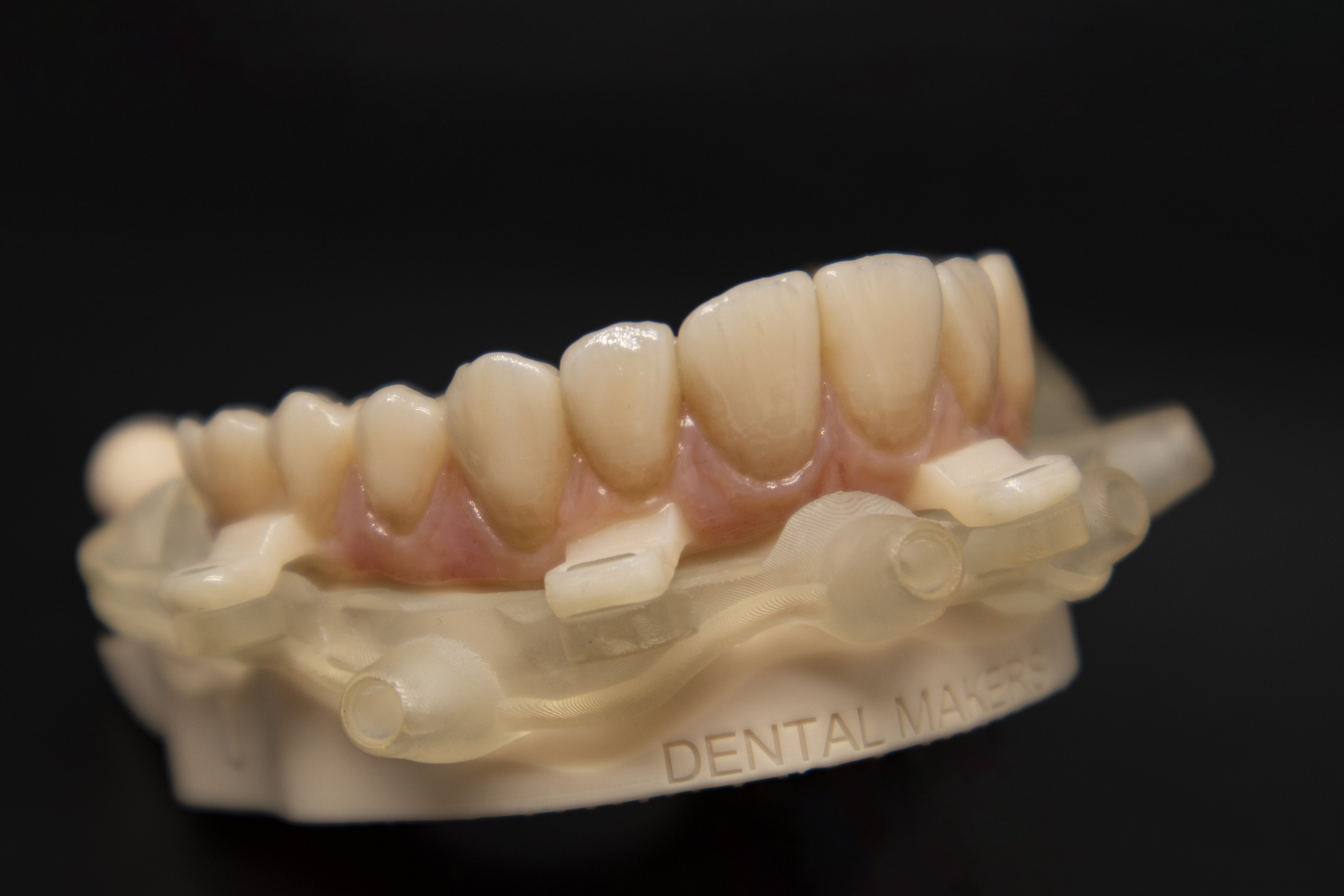 Protesi finita e toronto bridge 6