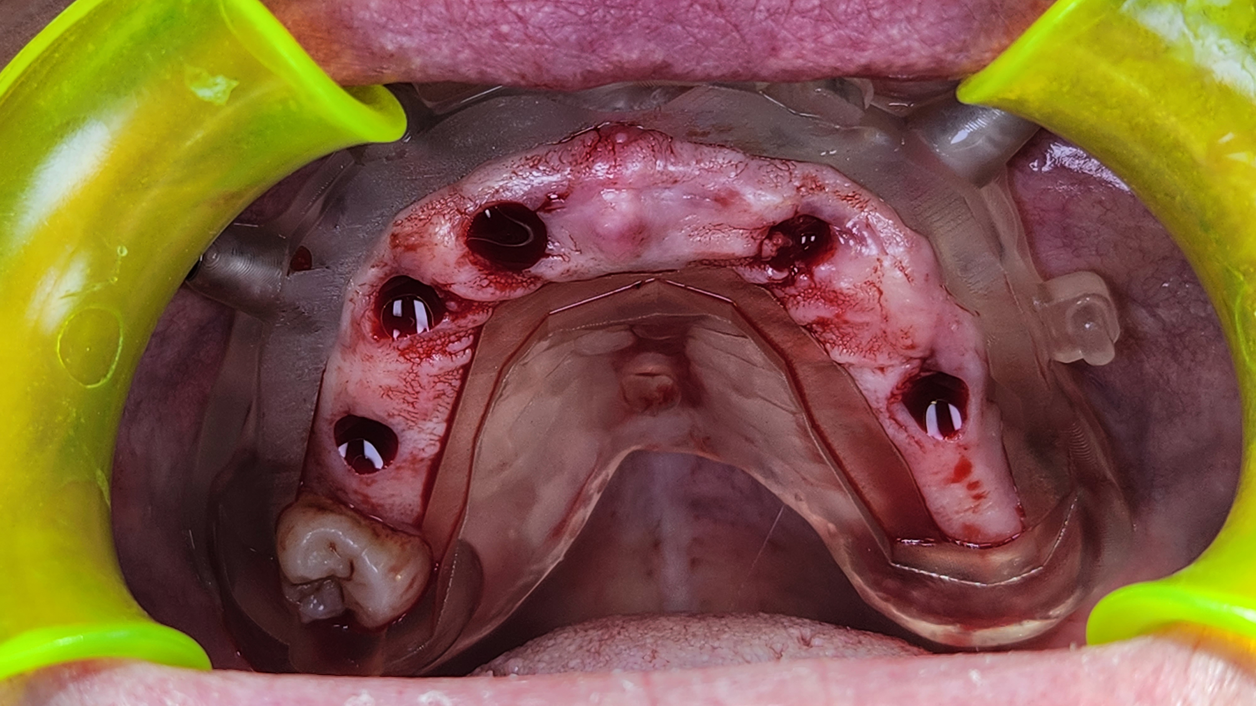 posizionamento degli impianti