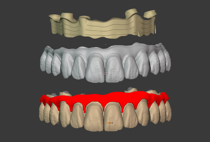 Separazione della parte estetica da quella di supporto (iBar) in Blander