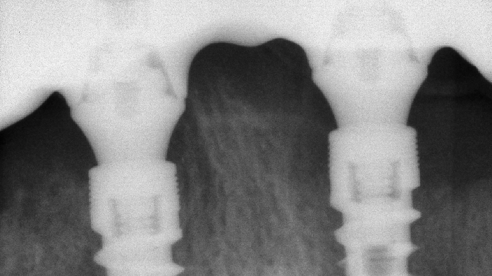 validazione radiografica